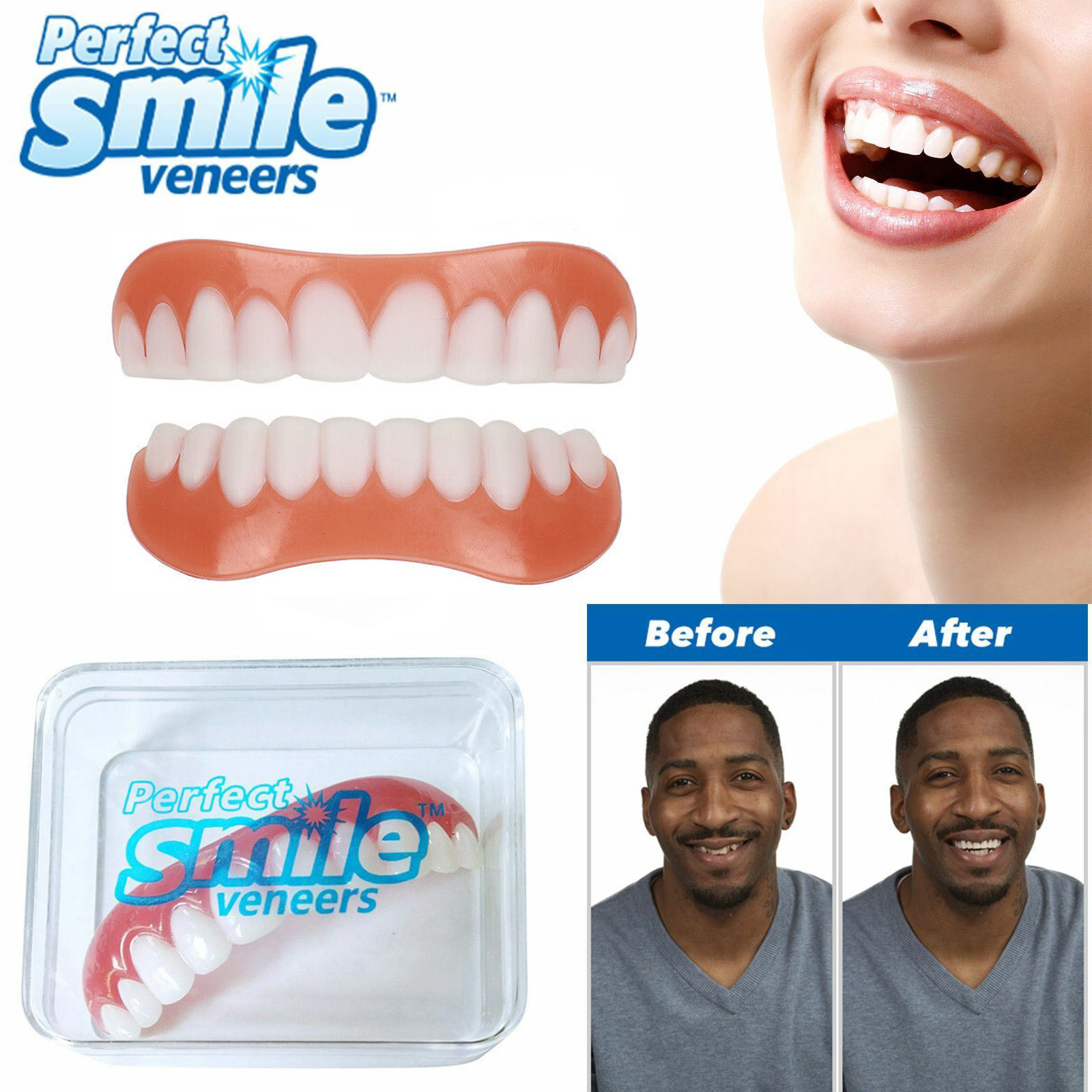 2pcs Set Perfect Smile Veneers Instant Cosmetic Teeth Cover Fix Snap On One Size Fits All